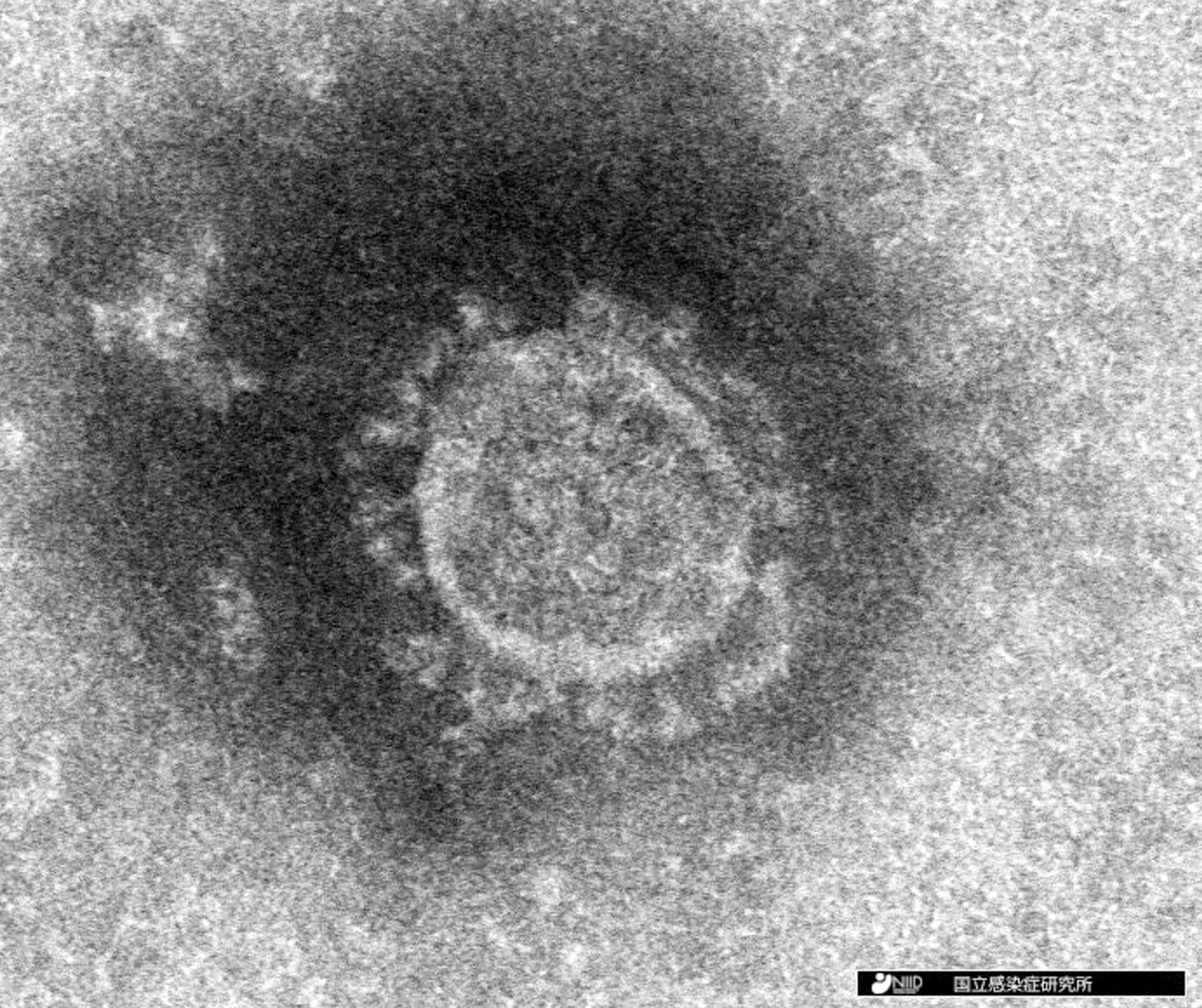 コロナウイルスの電子顕微鏡写真